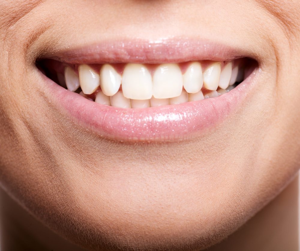 Schall- und Ultraschallzahnbürsten sorgen für strahlend weisse und saubere Zähne, wobei bei der Reinigung auch das Zahnfleisch geschont wird. (Bild: Olga Sapegina / Shutterstock.com)